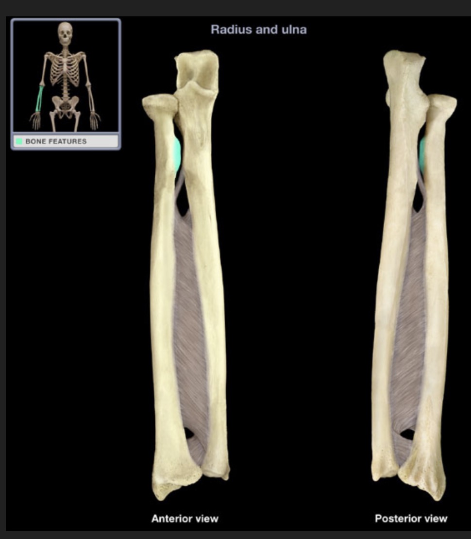 <p><span style="font-family: Arial, sans-serif; color: rgb(45, 59, 69)">a roughened elevation on radial shaft</span></p>