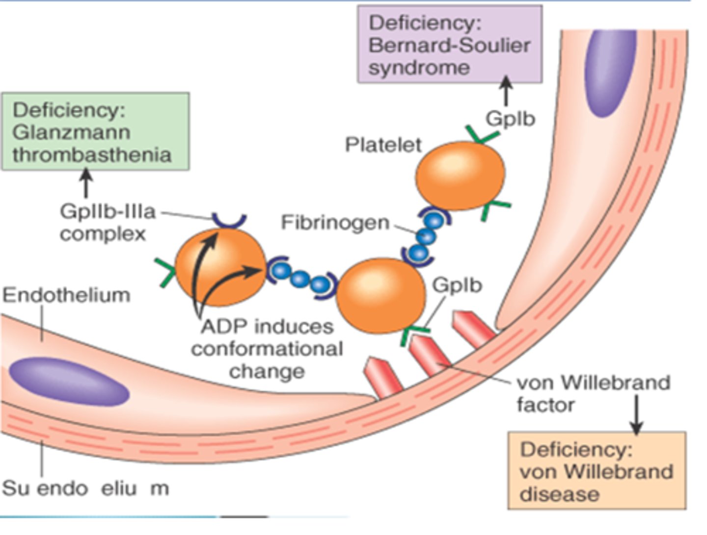 <p>Glanzmann thrombasthenia</p><p>(defect in platelet aggregation due to lack of GpIIb/IIIa)</p>