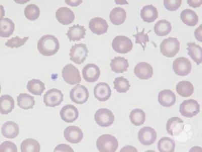 <p><br><span>Target cells</span></p>