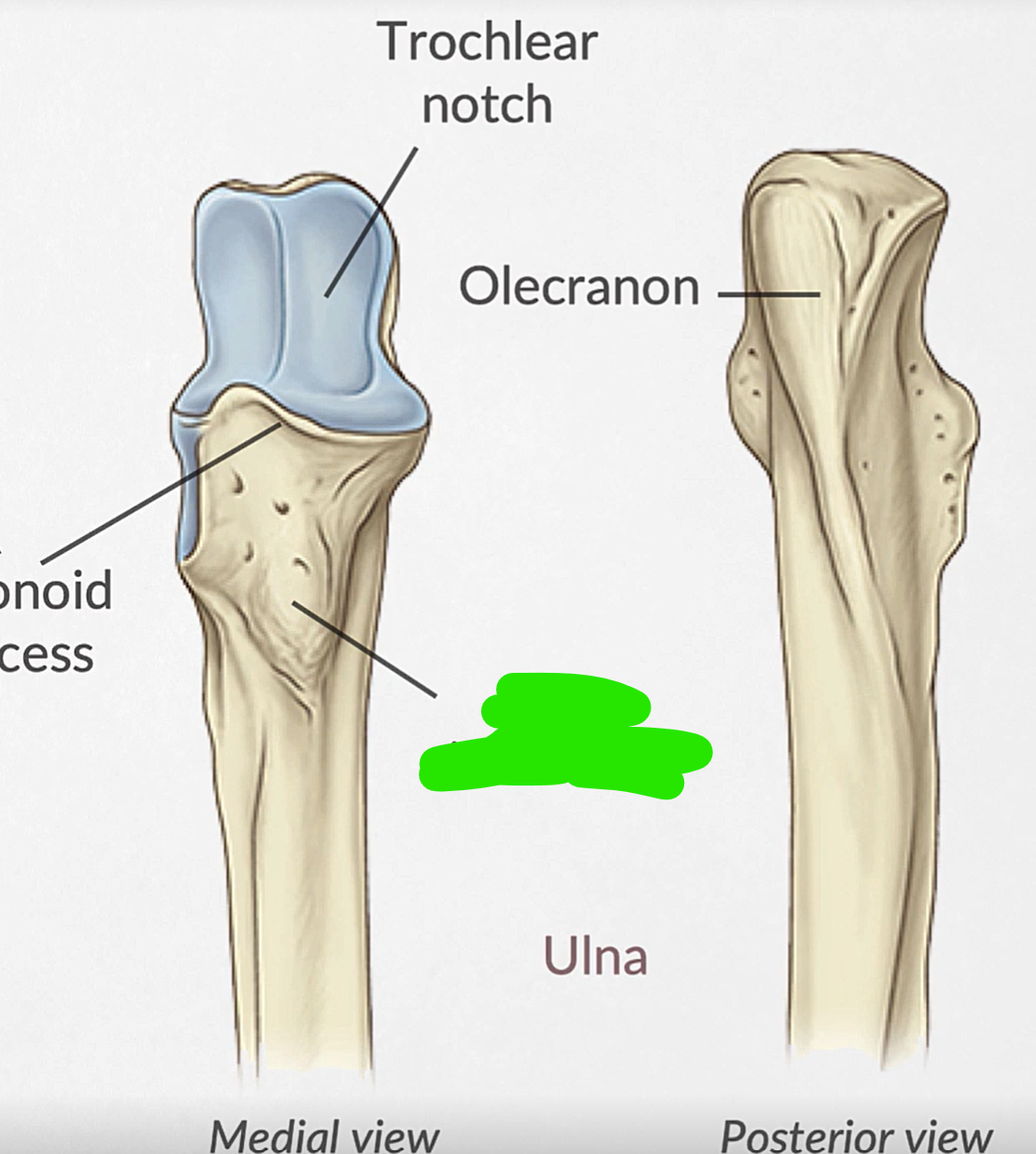term image