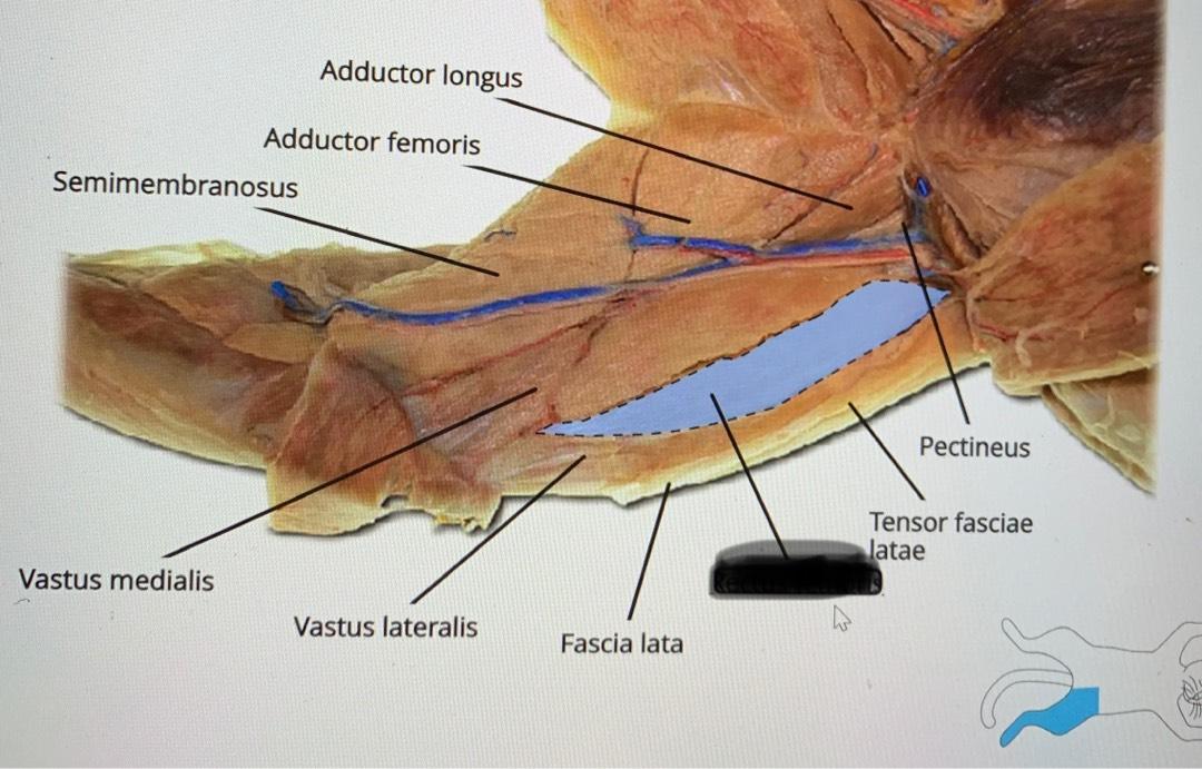 <p>Origin: Ilium</p><p>Insertion: Fascia Lata of the thigh</p><p>Action: Abducts thigh</p>