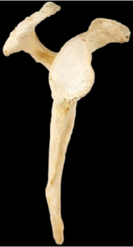 Which bone is in this image?