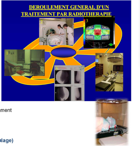 <p>→ Rôle crucial du <span style="color: red"><strong>radiophysicien</strong></span> qui va faire la dosimétrie du patient c’est-à-dire qu’il va <span style="color: red"><strong>modéliser la balistique du traitement</strong></span> : un générateur envoie des rayons selon différents angles dans le patient et l’objectif est de maximiser la dose reçue sur la zone tumorale. </p><p><em>Cette zone tumorale apparait en rouge et plus la couleur s’éclaircit, moins les tissus reçoivent de doses et plus ils sont épargnés</em></p><p>Une fois que c’est <strong>validé (validation médicale)</strong>, le patient peut faire ses séances avec parfois des recalages s’il bouge un peu. </p>