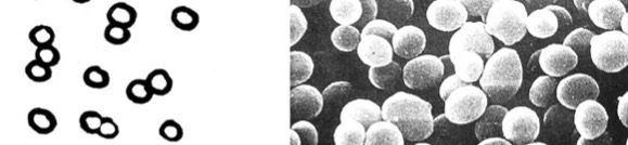 <p>What is the shape of the bacteria shown?</p>