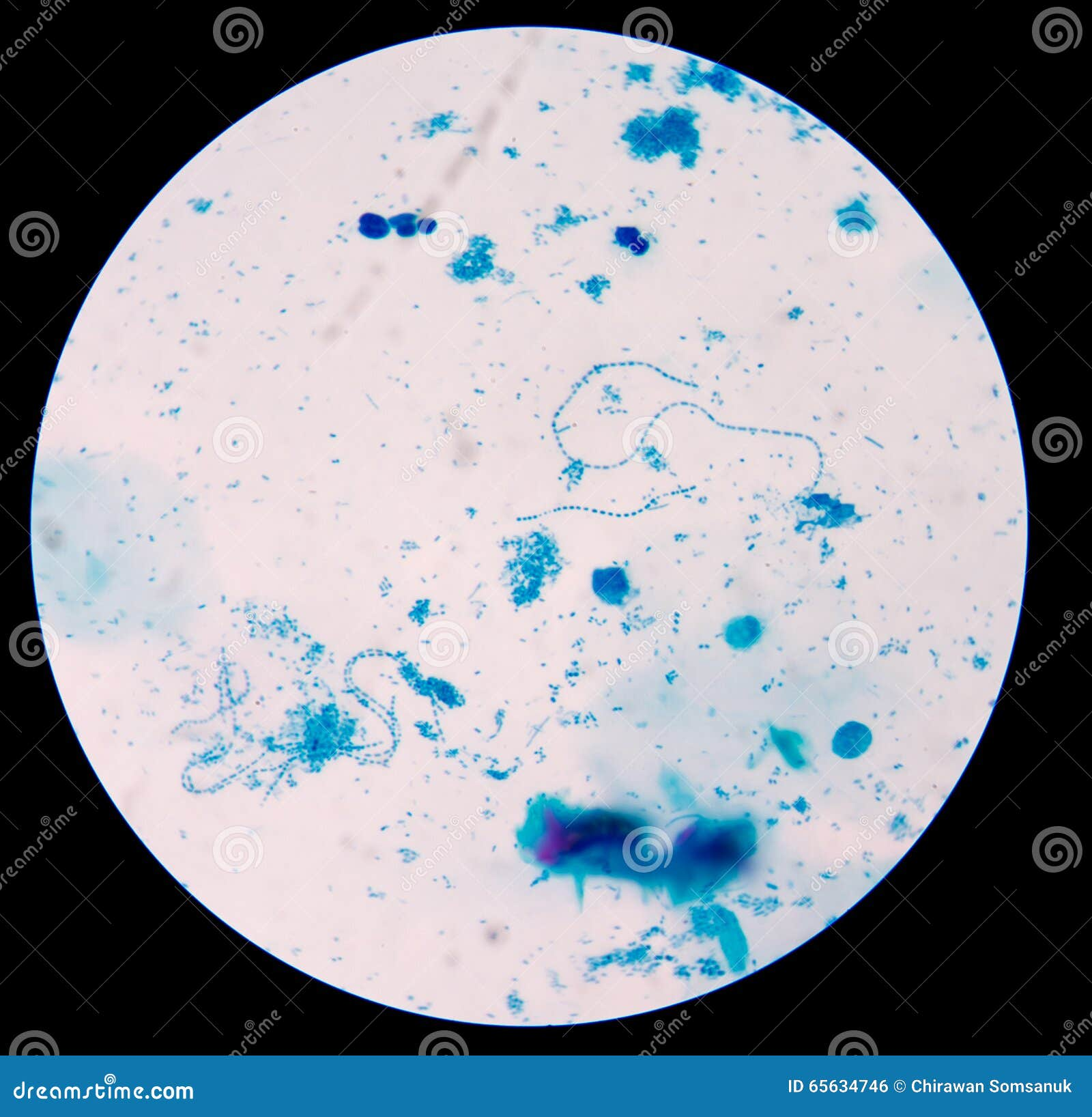 <p>(4) What shape is this bacteria?</p>