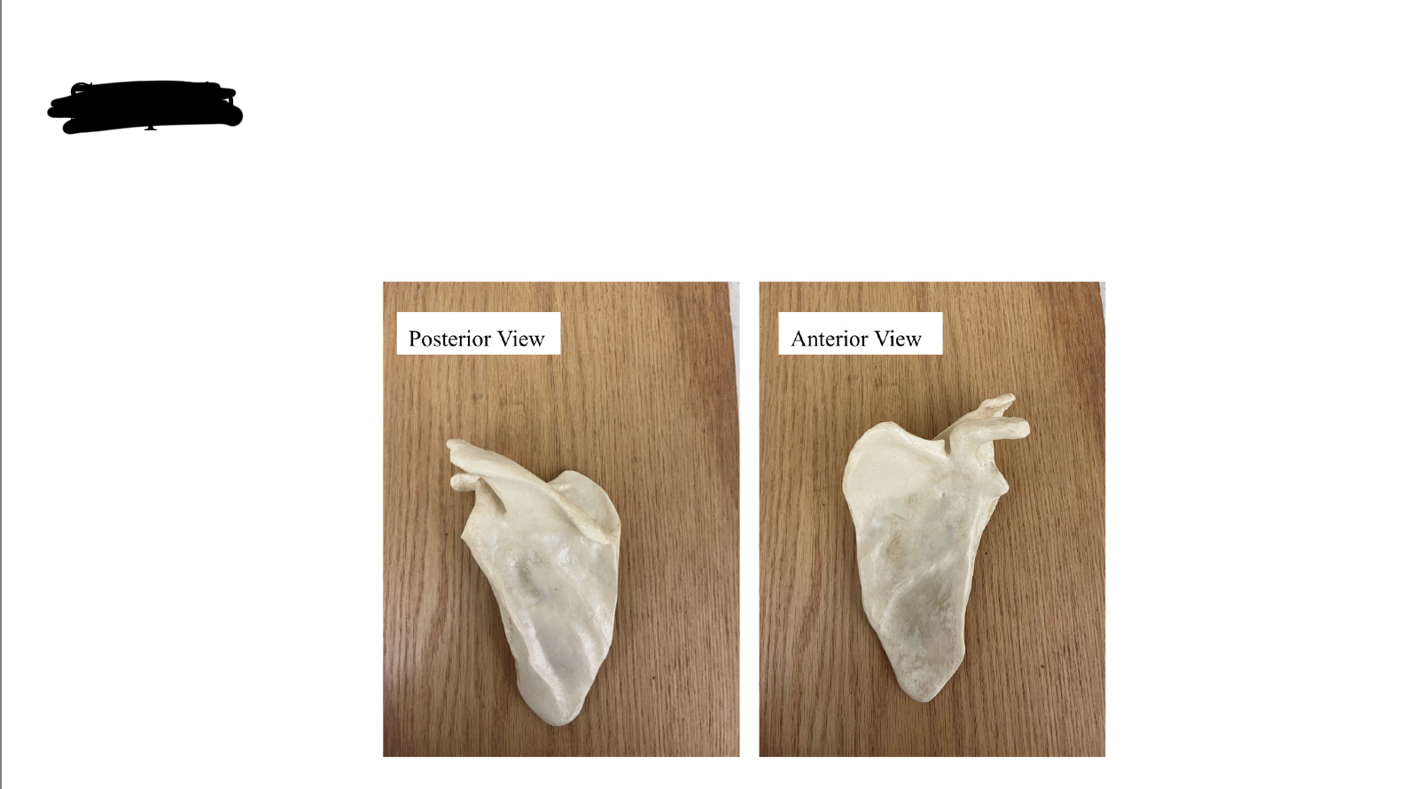 <p>Scapula</p>