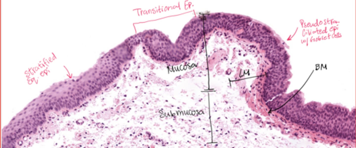 <p>The main transition occurs near the vocal cords, separating the squamous epithelium of the true vocal cords from the respiratory epithelium pseudostratified ciliated</p>