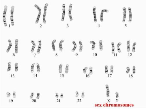 a picture of all of the chromosomes found in an individual 

* can be used to diagnose certain genetic problems, either before birth (using CVS or amniocentesis) or after birth