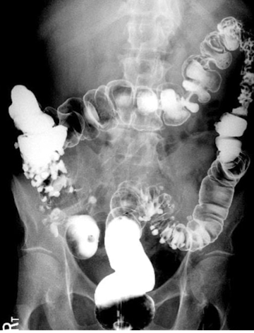 <p>What is this and what type of scan </p>