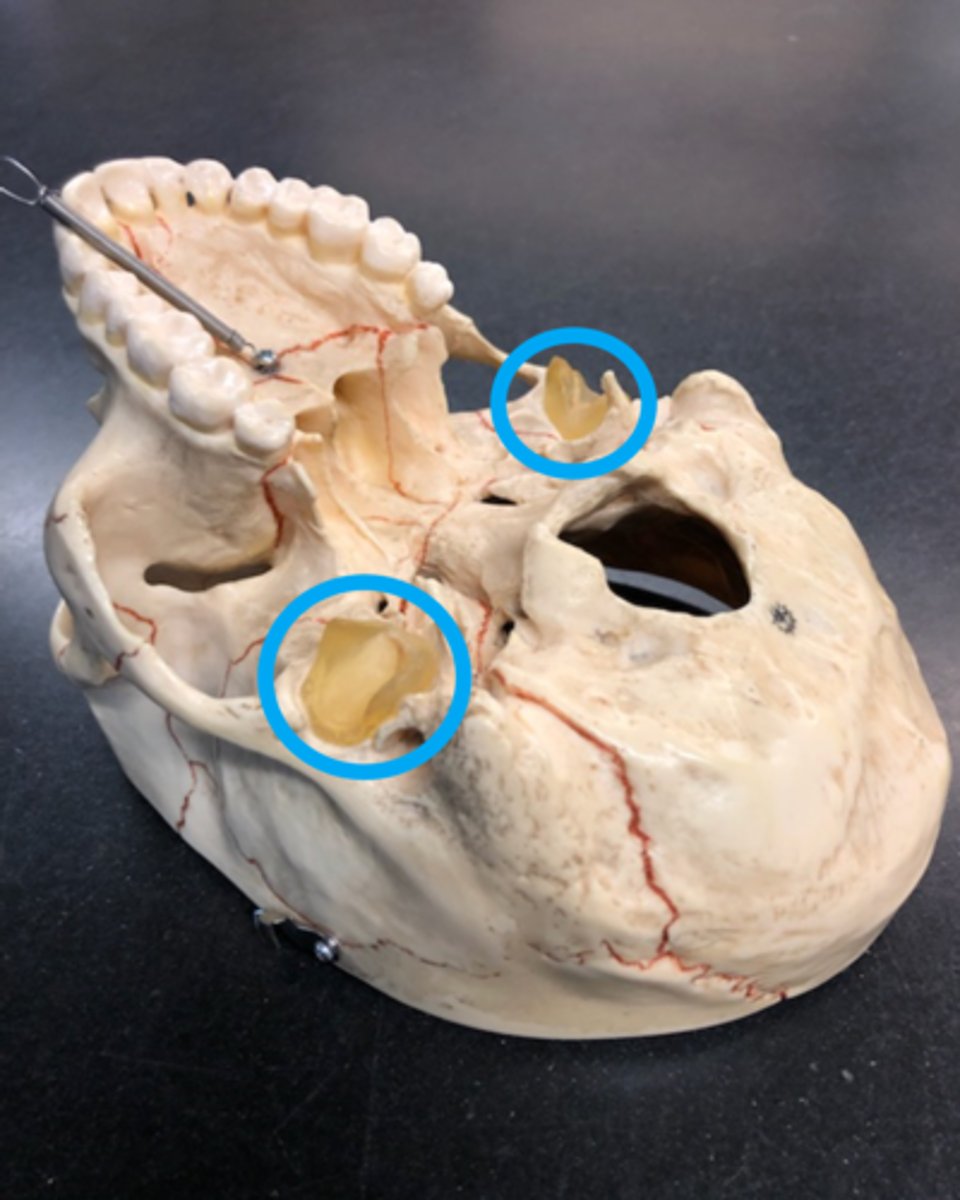 <p>Point where mandible attaches to temporal bone ("Gel like structure on model)</p>