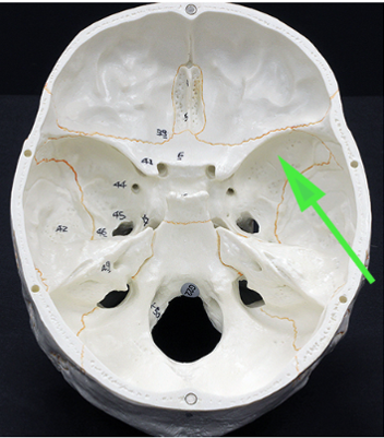 <p>What area of the sphenoid bone is indicated by the green arrow?</p>