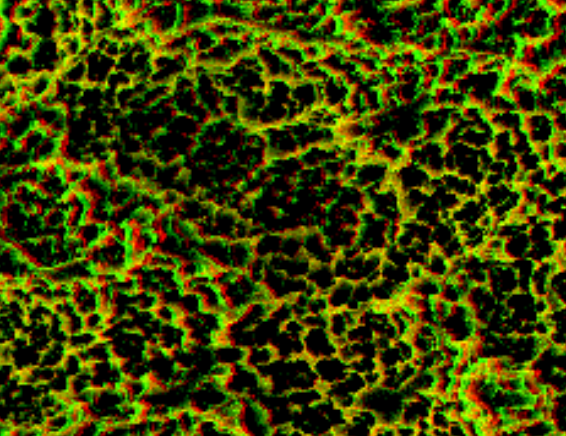 <p>What type of implant surface is preferred?</p>