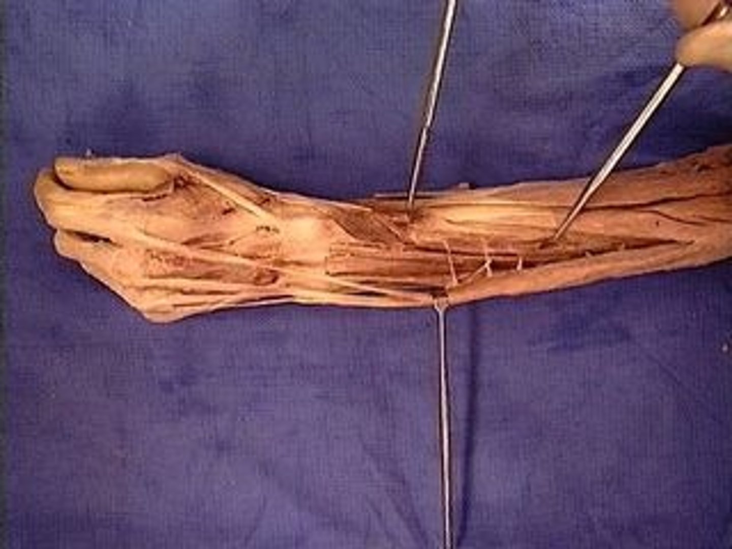 <p>Abducts and extends thumb</p>
