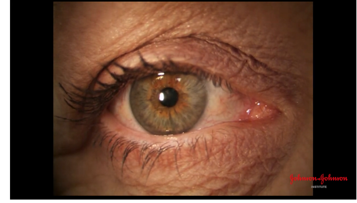 <p>Executing diffuse illumination </p>