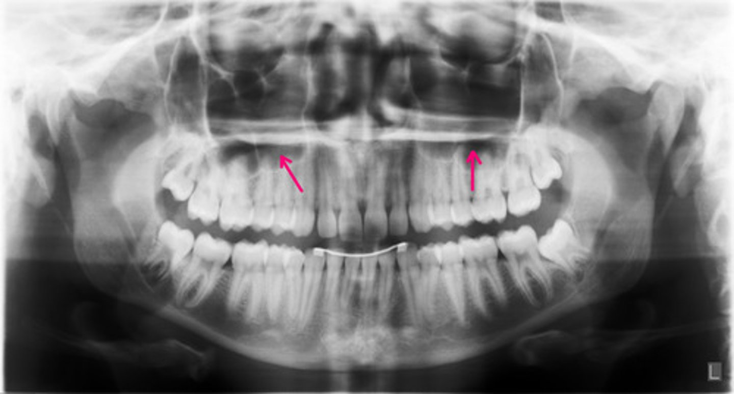 <p>Identify the structure.</p>