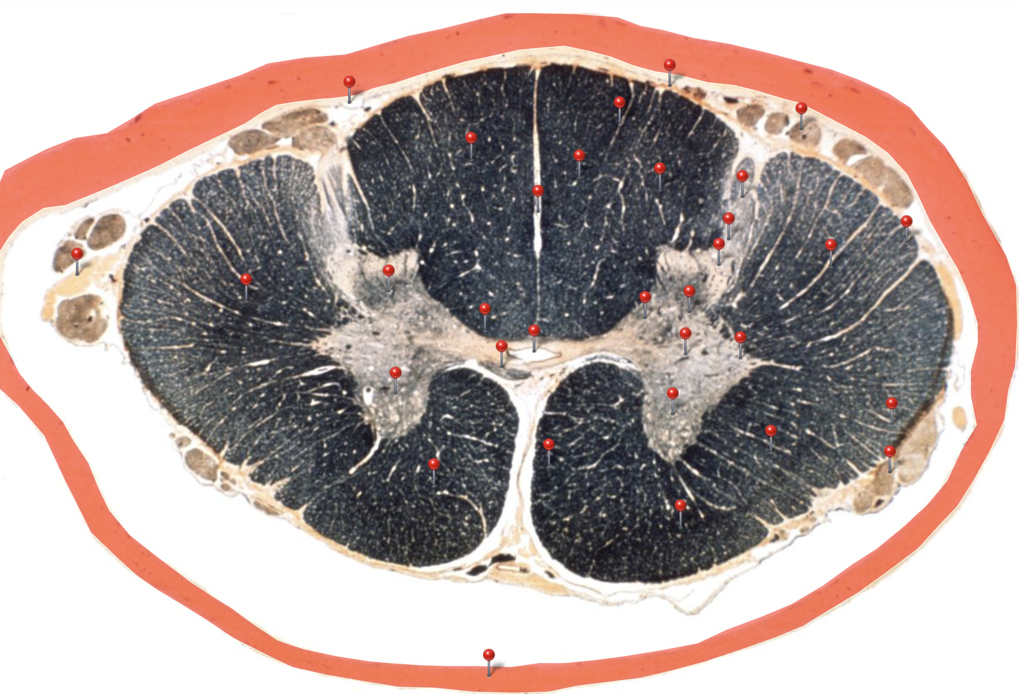 <p>Dura Mater</p>