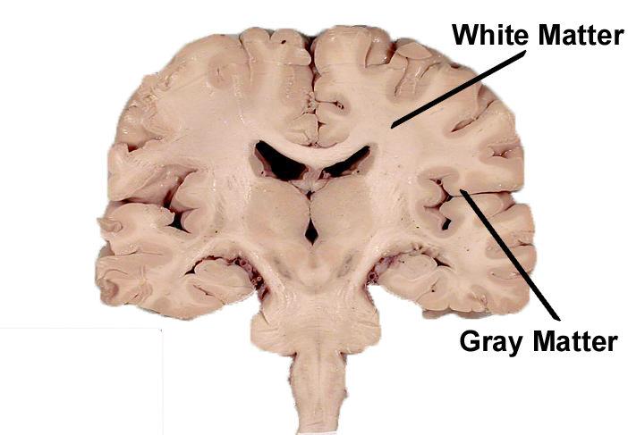 <p>White matter.</p>