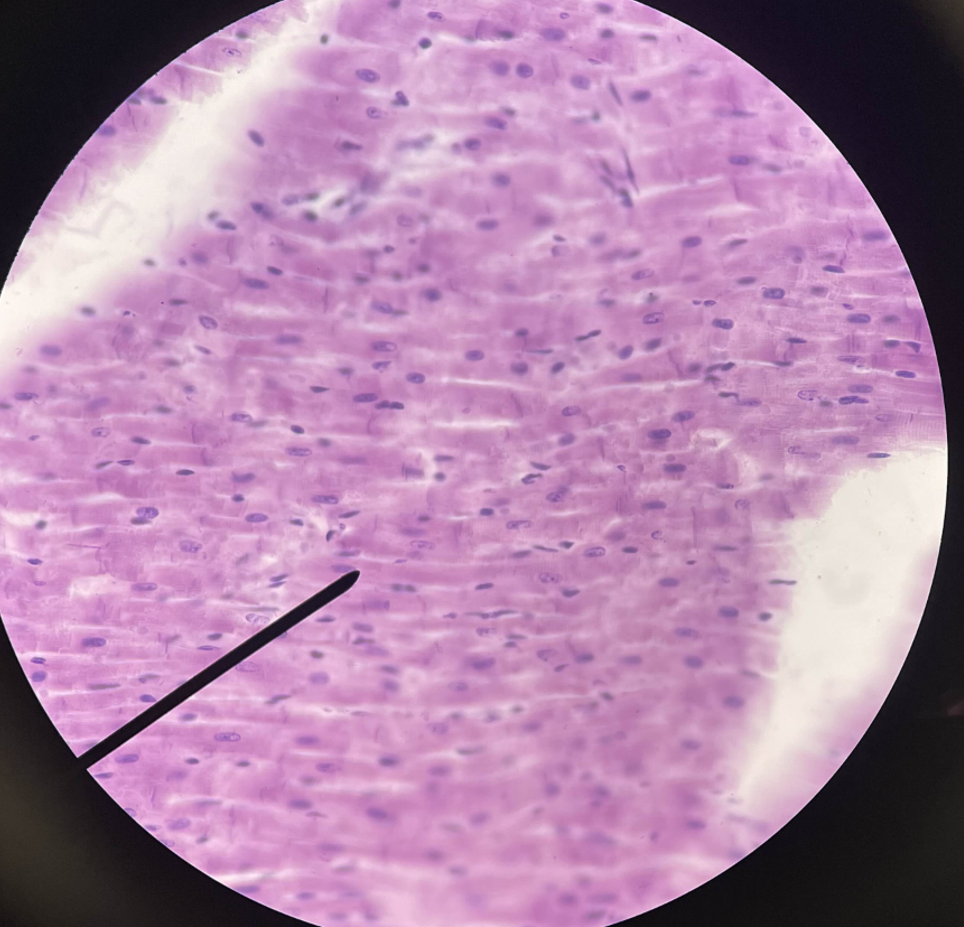 <p>What muscle is this?</p>