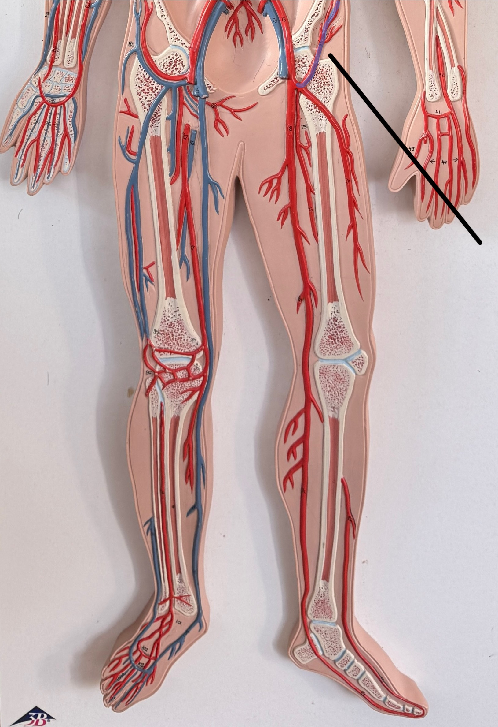 <p>Name this artery.</p>