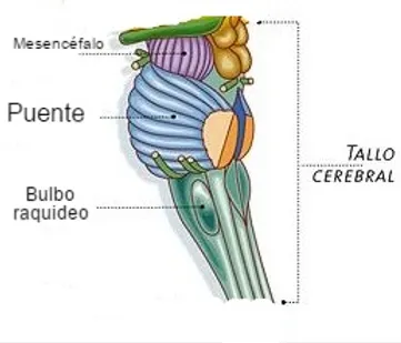 term image