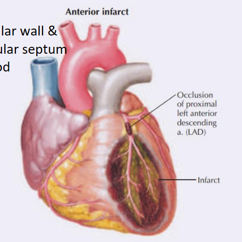 <p>Left ventricular wall & interventricular septum without blood</p>