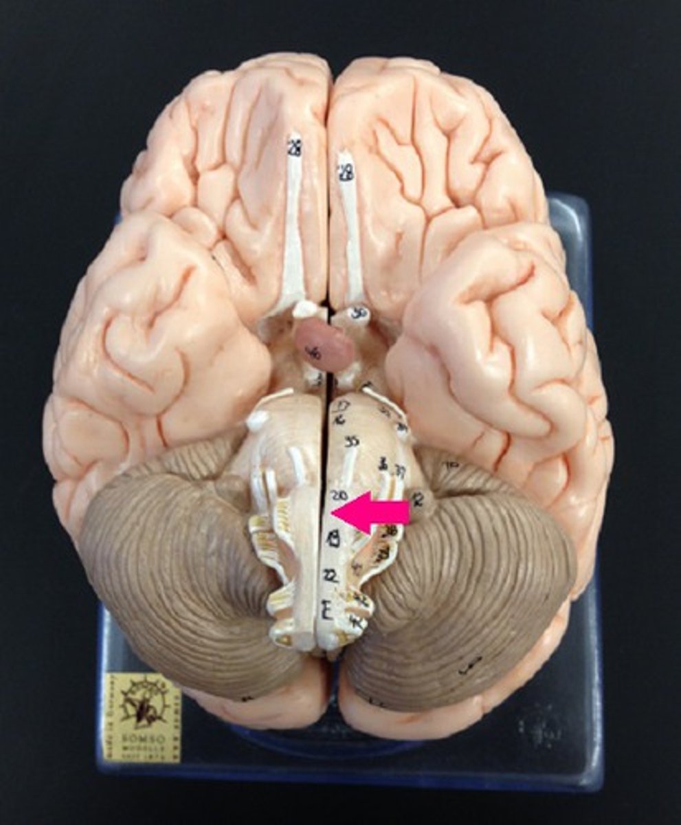 <p>Identify the structure.</p>