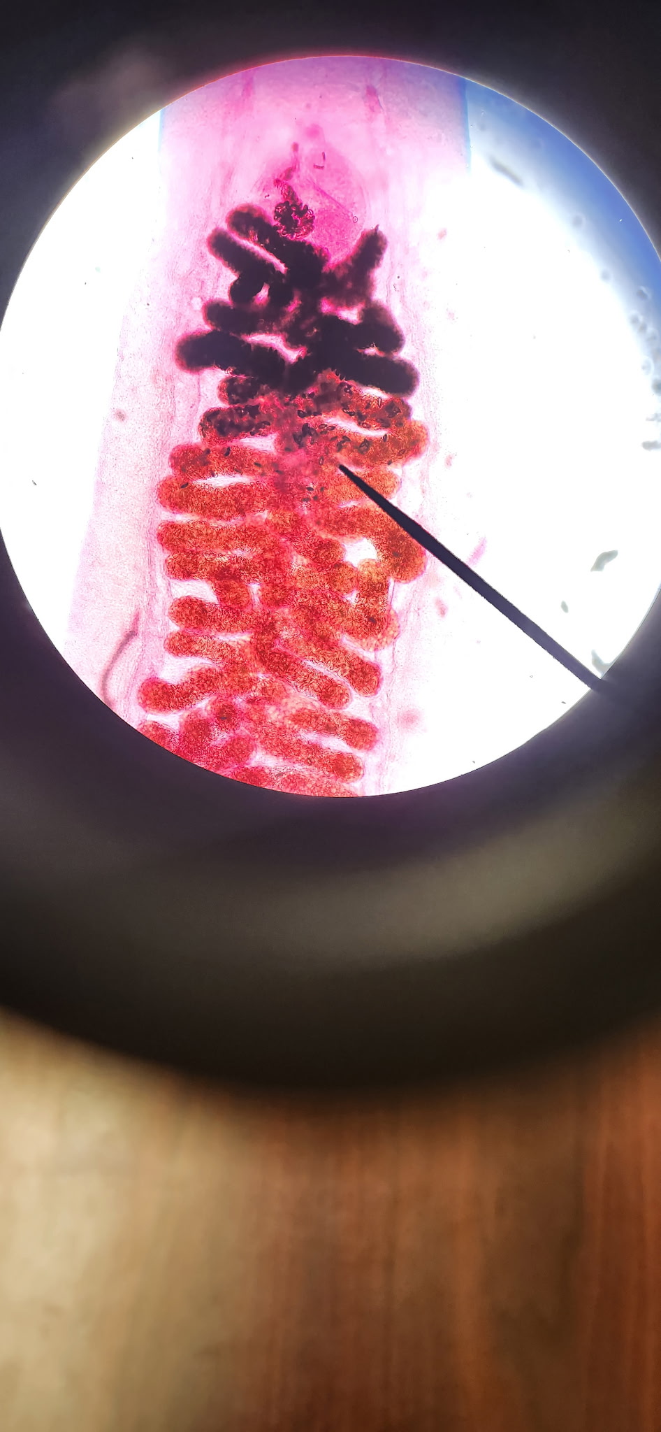 <p>What part of the Clonorchis sp. is this?</p>