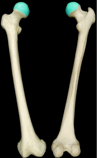 <p>proximal end of the femur; ball of the hip joint</p>