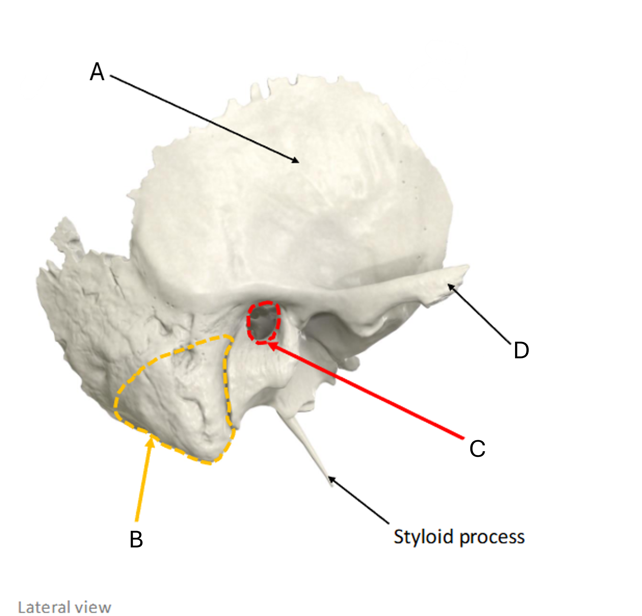 term image