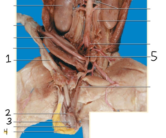 <p>What is 3? Purpose?</p>