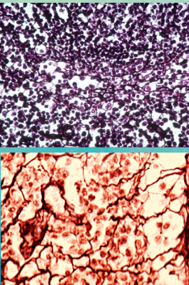 <ul><li><p><span style="background-color: transparent; font-family: "Book Antiqua", serif;"><span>Consists of a delicate network of reticular fibers</span></span></p></li><li><p><span style="background-color: transparent; font-family: "Book Antiqua", serif;"><span>Forms the stroma or internal supporting network in lymph organs</span></span></p></li></ul><p></p>