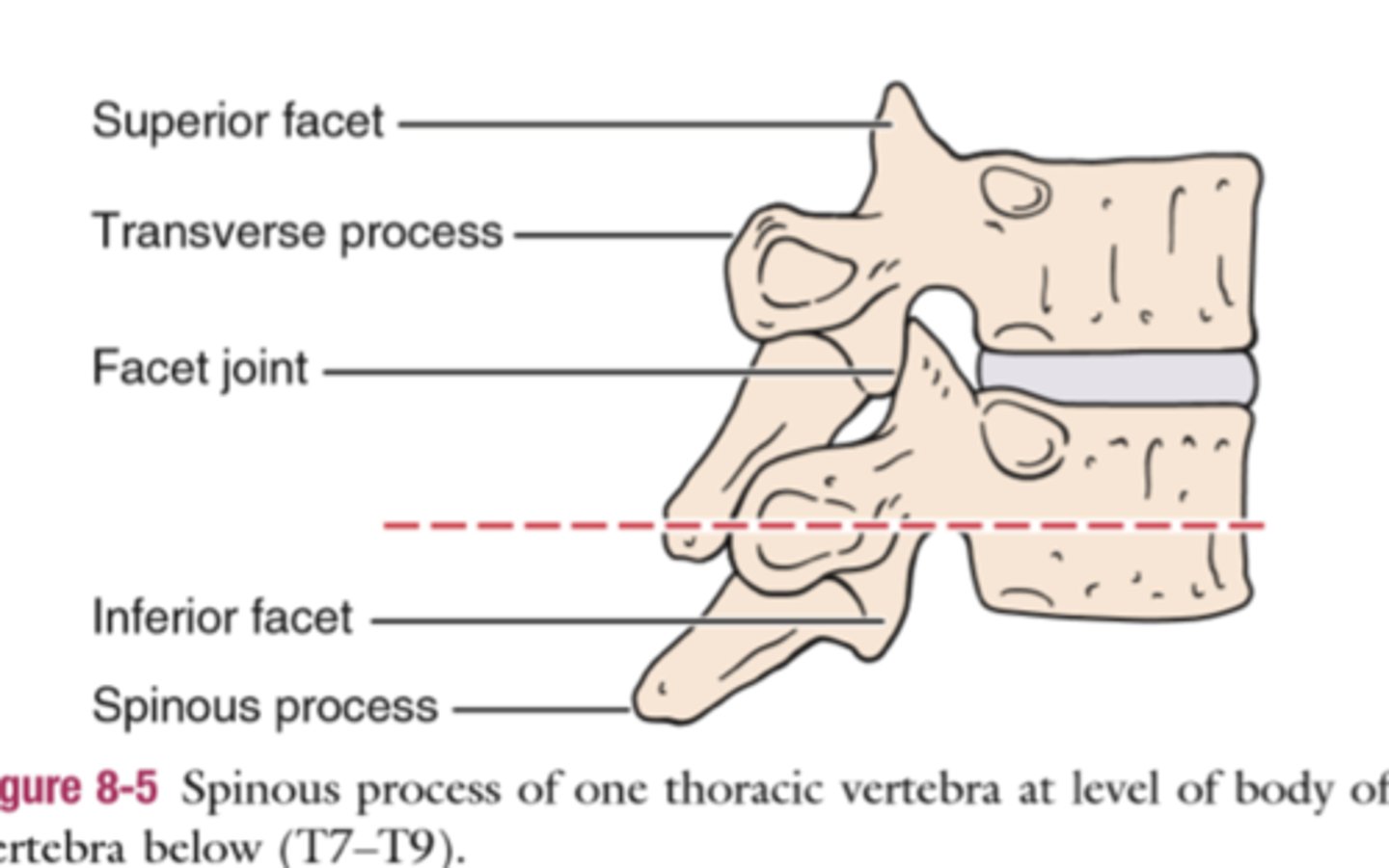 <p>the TPs of each thoracic vertebrae are generally at the level of the SP of the vertebra 1 level above throughout thoracic spine</p>