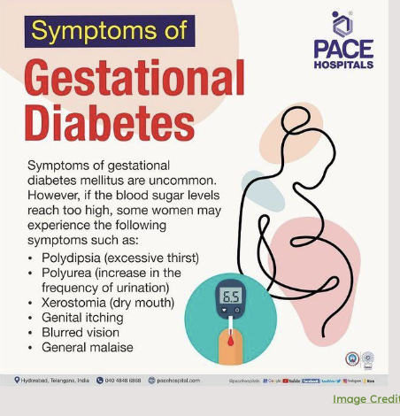 <ul><li><p>normal levels</p><ul><li><p>premeal = 60-95 mg/ dl</p></li><li><p>postprandial &lt;140 mg/dl</p><ul><li><p><strong>Post”</strong> = after</p></li><li><p><strong>“Prandial”</strong> = related to eating or a meal</p></li></ul></li></ul></li><li><p>classifications</p><ul><li><p>A1 GDM - diet controlled</p></li><li><p>A2 GDM - controlled with meds / insuling</p></li></ul></li></ul><p></p>