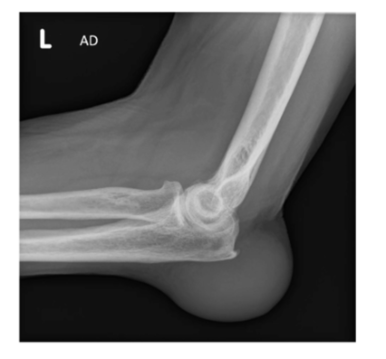 <p>Describe the MOST obvious "ABCS" component.</p>