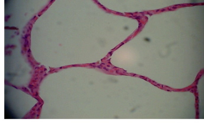 <p>single layer of flattened cells Allows</p><p>allows materials to pass through diffusion</p><p>located in lungs </p>