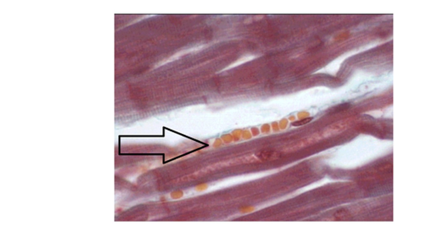 <p>T/F: The arrow is pointing at a venule.</p>