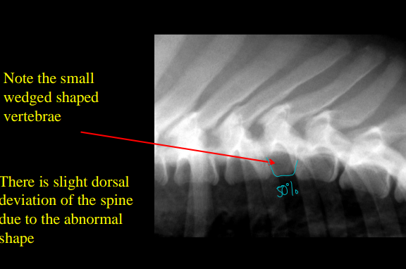 <p>Hemivertebrae </p>