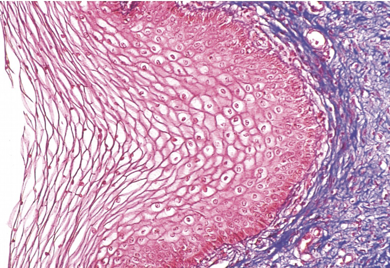 <p>Stratified Squamous Epithelium Non-Keratinzed</p>