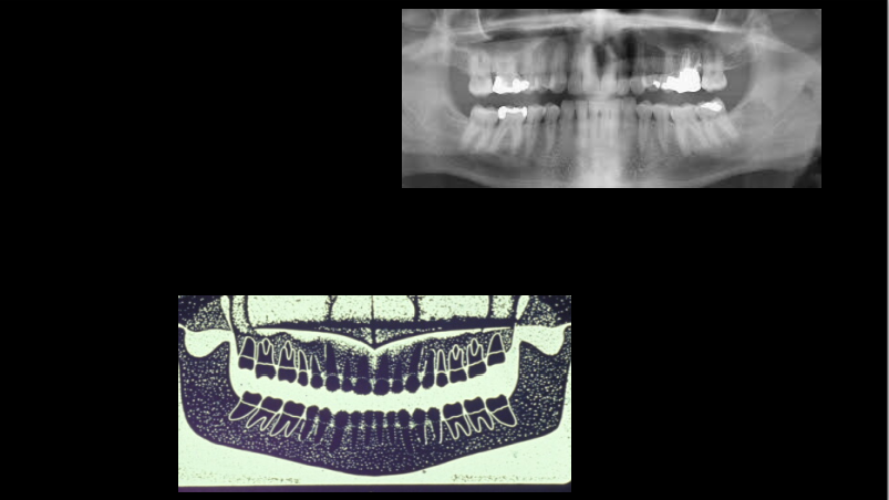 <p>What error is shown in each photo?</p>