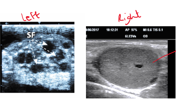 <p>You are presented with a cow that has not been seen bulling i.e. not showing oestrus signs. On ultrasound, the left &amp; right ovary appear as in the picture. How do you suggest this animal is managed. </p>