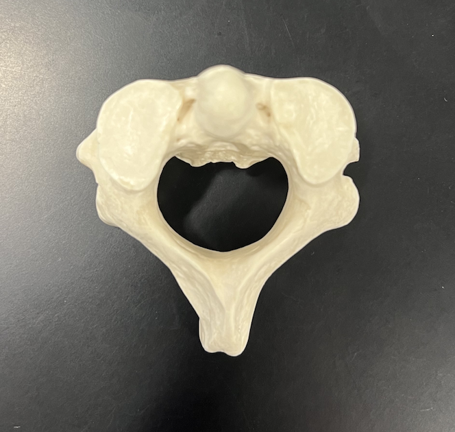 <p>what vertebrae is this</p>