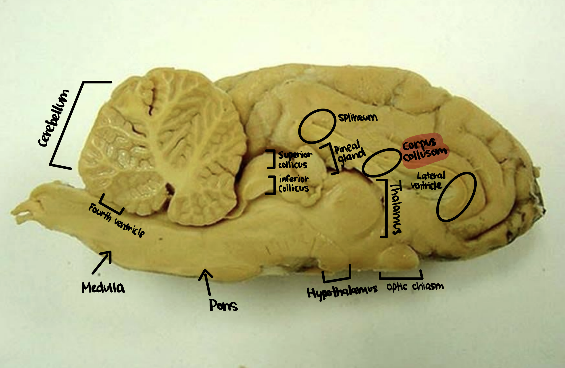 <p>Corpus Collusom</p>