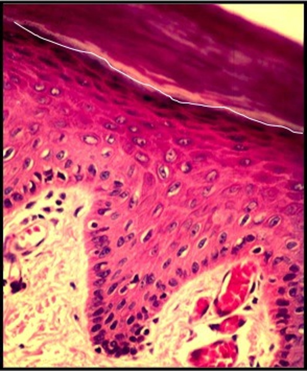 <p>DEFINITION</p><p>only found in thick skin; thin, translucent band superficial to the stratum granulosum; a few rows of flat, dead keratinocytes</p>