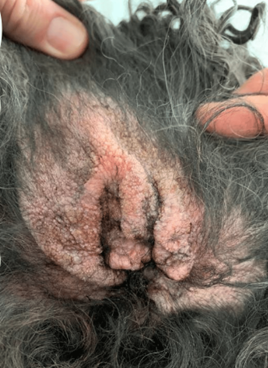 <p>acute or chronic otitis?</p>