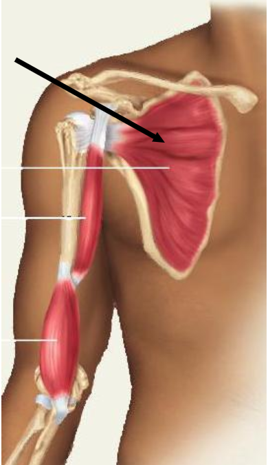 <p>Identify the indicated muscle of the scapula</p>