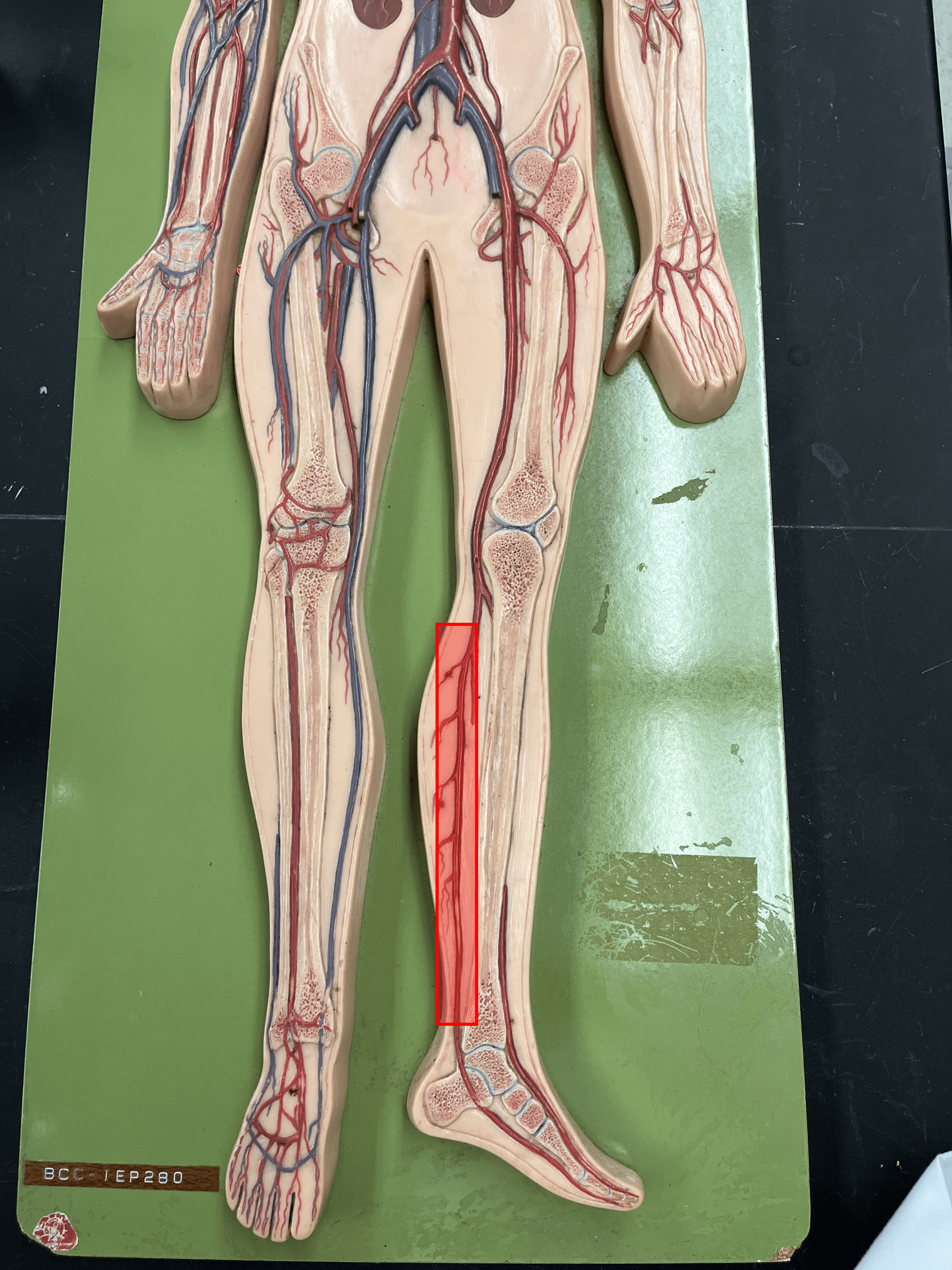 <p>• An artery of the lower limb.</p>
<p>• Originates as the continuation of the popliteal artery.</p>
<p>• Supplies the posterior lower leg muscles.</p>