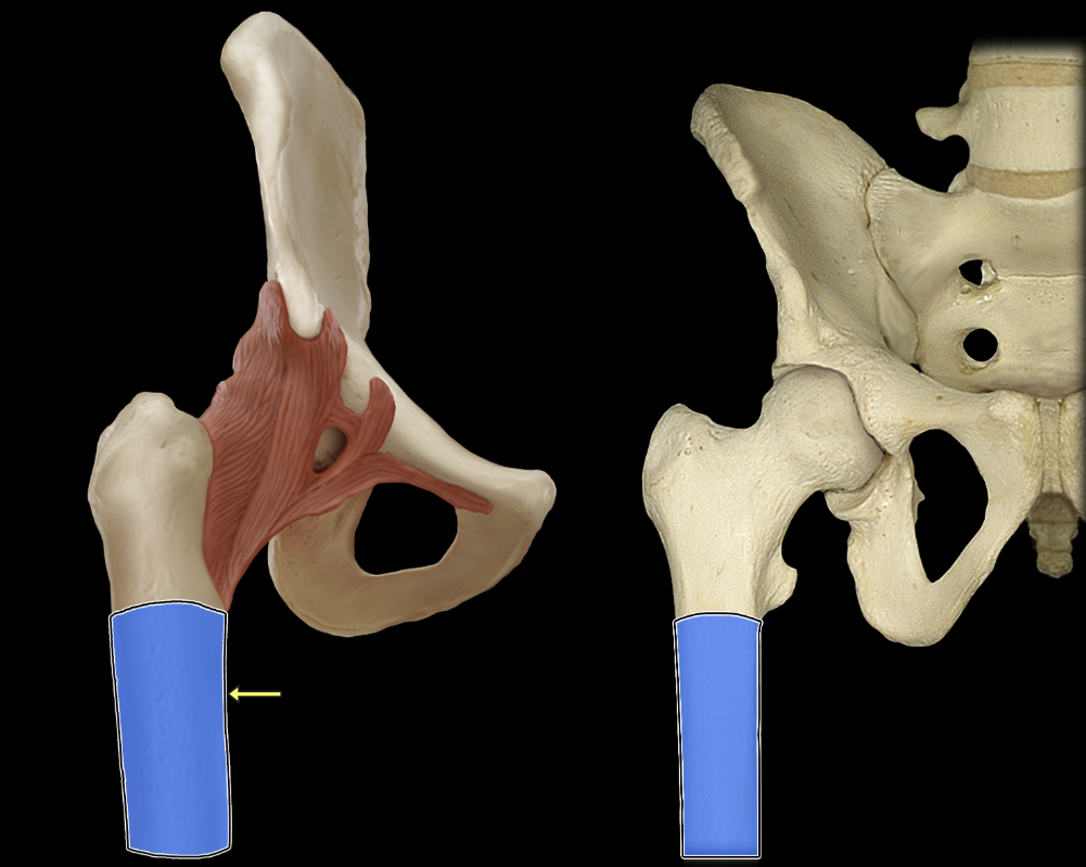 <p>Shaft of femur</p>