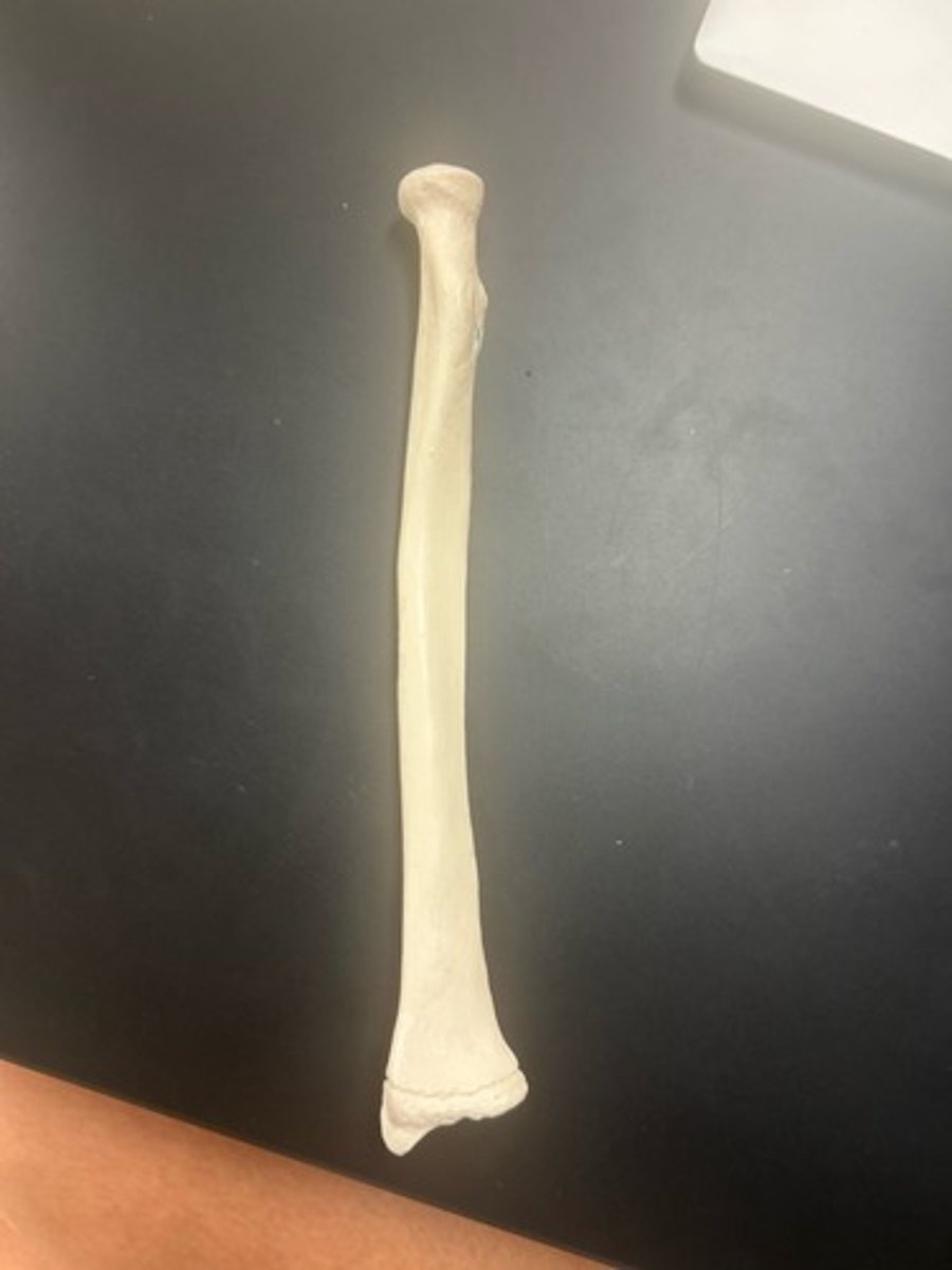 <p>name the bone</p>