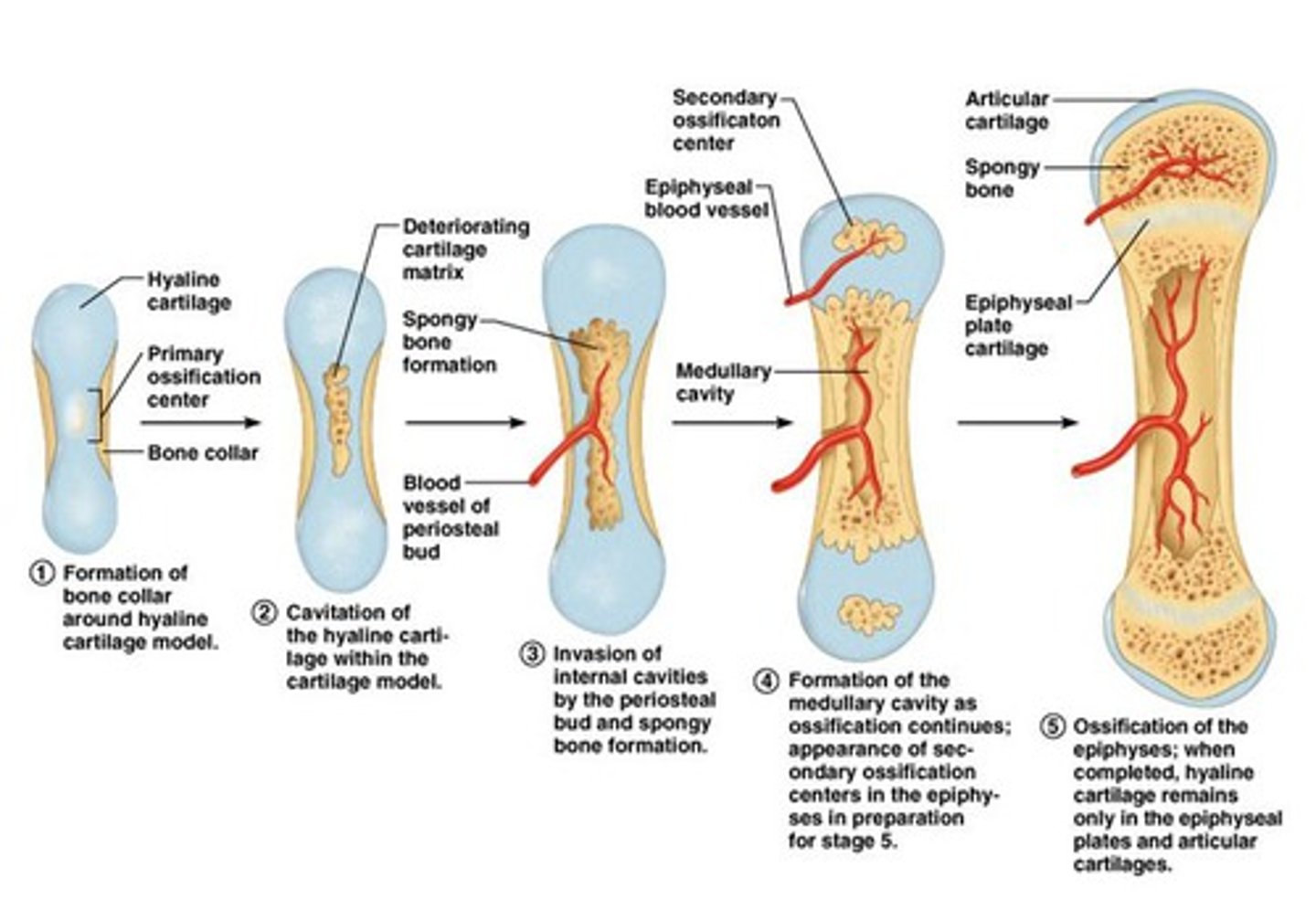 <p>1) Bone collar forms around the diaphysis of the hyaline cartilage model.</p><p>2)Cartilage in the center of the diaphysis calcifies and then develops cavities.</p><p>3)The periosteal bud invades the</p><p>internal cavities and spongy bone forms.</p><p>4) The diaphysis elongates and a medullary cavity forms. Secondary ossification centers appear in the epiphyses.</p><p>5)The epiphyses ossify. When completed, hyaline cartilage remains only in the epiphyseal plates and articular cartilages.</p>
