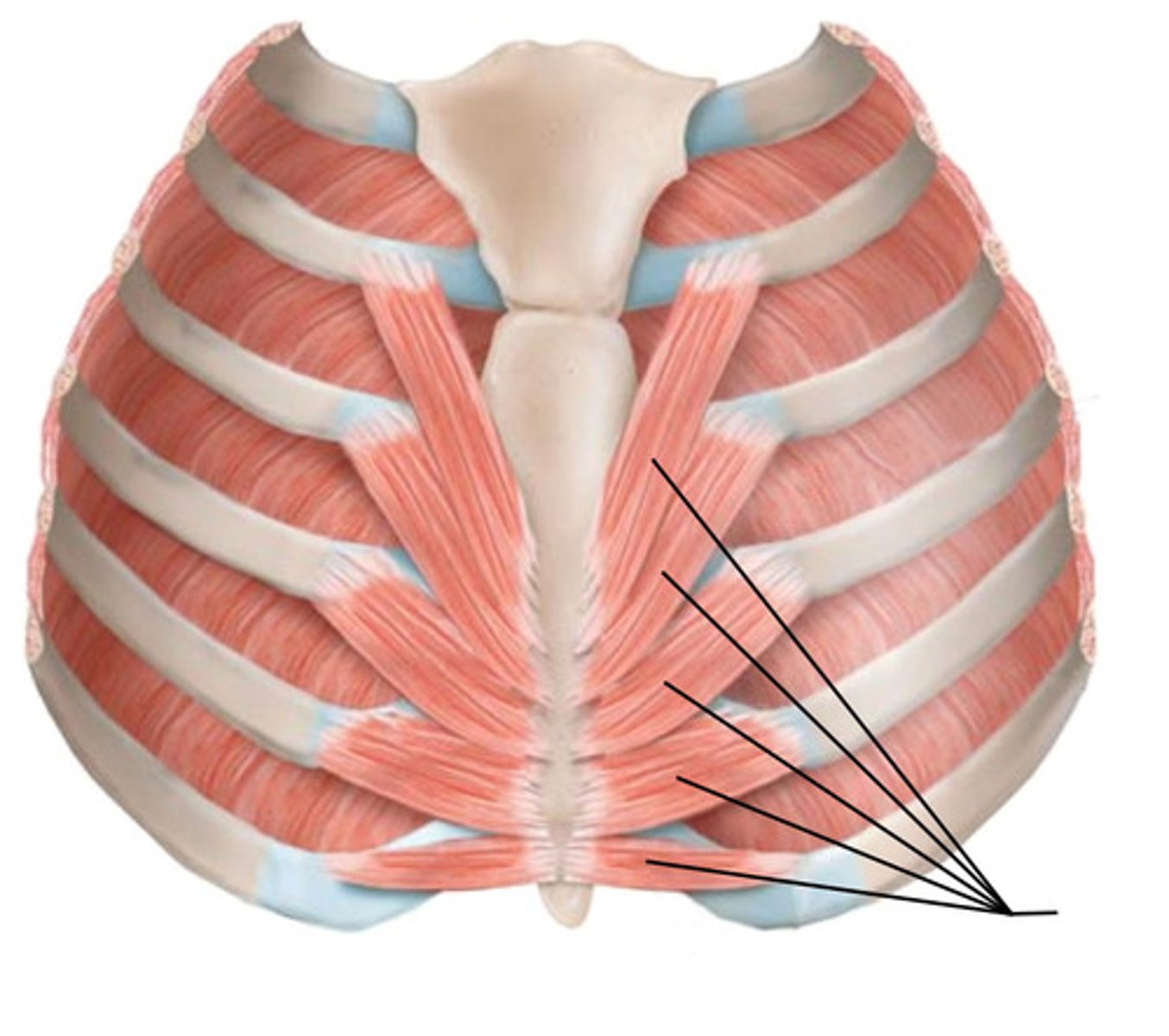 <p>Transverse Thoracis</p>